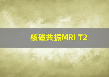 核磁共振MRI T2